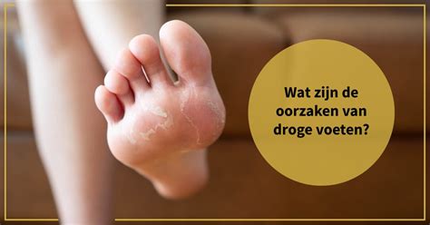 wat veroorzaakt vocht in voeten